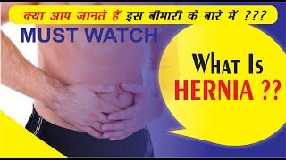 Understanding Hernia | Ep 1 | जानिये समझिये क्या है हर्निया | Your Friendly Surgeon | Dr Shivanshu