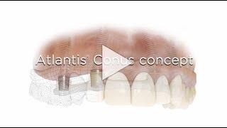 Atlantis Conus concept