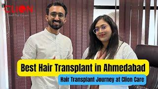 Best Hair Transplant in Ahmedabad | ClionCare | Expert Advice | Affordable & Natural Results