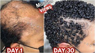 how I treat repair my damaged hair with one ingredient and here is my 30 day results