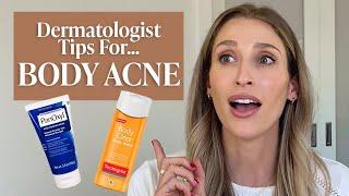 Body Acne or Folliculitis? Dermatologist Tips & Drugstore Skincare Products to Try | Dr. Sam Ellis