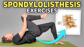 5 Exercises for Lumbar Spondylolisthesis