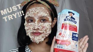 5 DAYS OATMEAL MASK ON ACNE PRONE SKIN