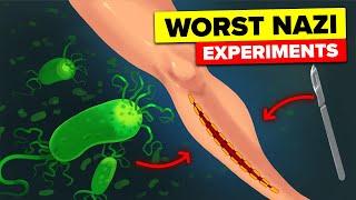 Bacteria Inside Wounds - Nazi Camp Experiments