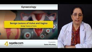 Benign Lesions of Vulva and Vagina | Gynaecology Lectures | Medical Student | V-Learning™