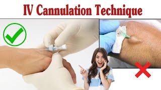 Intravenous Cannulation Technique || IV Cannula Procedure