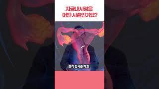 자궁내시경은 어떤 시술인가요?｜산부인과 장용수 교수 #3편 #shorts