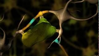 Neuronal Degeneration 3D