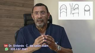 LA CIRCUNCISIÓN DR. SIVIARDO C. DE LEON JAEN