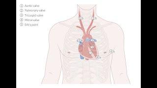 Cardiovascular Examination - Clinical Examination of the Heart