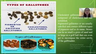 Gallstones, Chr. Cholecystitis and Functional Biliary Disorders. Dr. Irina Kolomytseva (MA groups)