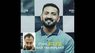 Abdul Malik Fareed Hair Transplant Experience/Hair Transplant Story #shorts #abdulmalikfareed