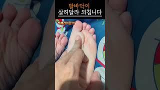 발바닥에 이런 증상 있다면, 심각합니다｜간·심장 경고