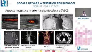 Scoala de vara a tinerilor reumatologi Sibiu 12 - 16 iulie - Daniela Opris Belinski