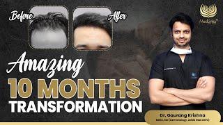 Amazing 10 Months Hair Transformation! | MedLinks