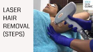Underarm Hair Removal Laser Treatment(Fast) | Laser Hair Removal in Delhi and Gurgaon