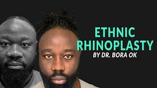 ETHNIC RHINOPLASTY BY DR. BORA OK in ISTANBUL | BEFORE and AFTER