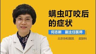 螨虫叮咬后的症状 螨虫叮咬后有什么临床表现 有来医生