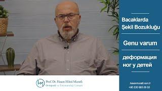 Gena varum | Prof. Dr. Hasan Hilmi Muratlı - Ortopedi ve Travmatoloji Uzmanı