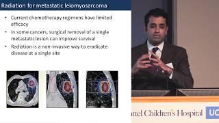 Radiation Therapy for Leiomyosarcoma - Anusha Kalbasi, MD | UCLA Cancer Care