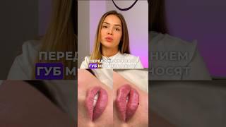 Анестезирующий крем практически не работает #косметология #увеличениегуб #врачкосметолог