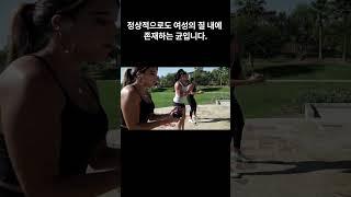 여성 질염, 칸디다질염 원인 및 증상, 예방법, 치료방법, Q&A