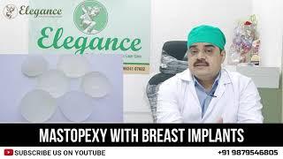 Mastopexy With Breast Implants Surgery By Dr. Ashutosh Shah, Elegance Clinic Surat Gujarat, Mumbai,