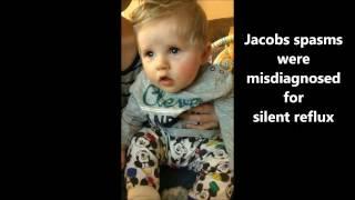 Infantile Spasms/ West Syndrome Awareness: Unusual Baby Twitches, Seizures, Jerking, Epilepsy
