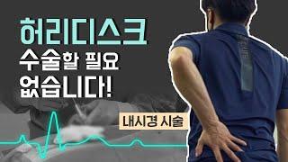 허리디스크 수술할 필요 없습니다! (김해바른병원 / 055-903-1234)