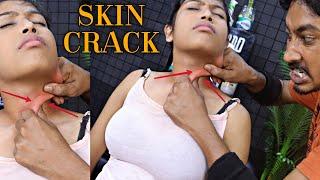 Relief Anxiety with Skin Cracking | Head Massage & Forehead Tappings | Neck Cracking | ASMR