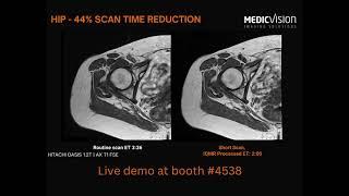 RSNA 2023 - Come to the Medic Vision booth for the latest in AI for Medical Imaging