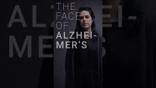 The Face of Alzheimer's: 5 million Americans Diagnosed 2018