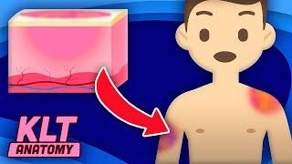 Why Do You Get Bruises?! | KLT Anatomy