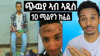 ጭዉያ ኣብ ኣዲስ ኣበባ | 10 million
