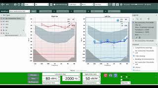 Pure-Tone Audiometry In Auditdata Measure