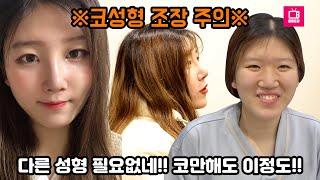 코성형'만' 했어요 주먹코 성형 상담부터 회복까지! 코 하나로 이미지가 이렇게 바뀐다고? 대박 전후 차이 진짜 예뻐진 코성형 부기 관리까지 낱낱이 공개합니다[쀼]