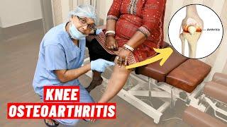 Knee Osteoarthritis Chiropractic Treatment I Dr. Sanjay Sarkar (USA) I Call 9903026262