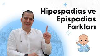 Hipospadias ve Epispadias Farkları