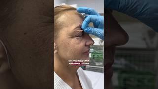 Девственное лицо Пластический хирург НИКОЛАЕВА САНДАРА АФАНАСЬЕВНА