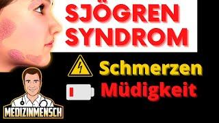 Schmerzen & Bleierne Müdigkeit Den Ganzen Tag  POLYNEUROPATHIE beim Sjögren Syndrom (Arzt erklärt)