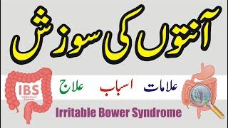 Anton ki sozish ka ilaj / Ibs (irritable bowel syndrome) / Anton ki sujan or zakhm ka ilaj in urdu.