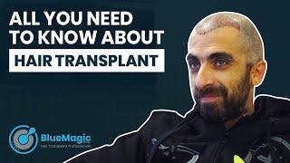 All You Need To Know About Our Hair Transplant Service | Hair Transplant Reviews