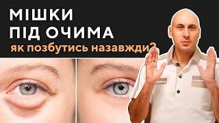 Мішки під очима - як позбутись назавжди? Чому креми не допомагають?