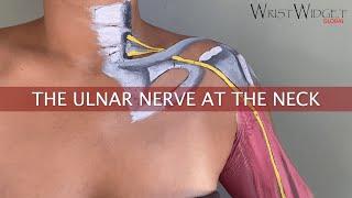 The ulnar nerve at the neck