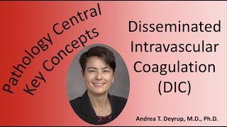 Medical School Pathology: Pathophysiology of Disseminated Intravascular Coagulation (DIC)