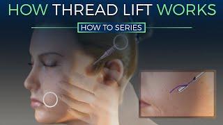 How Thread Lift Works - HOW TO SERIES