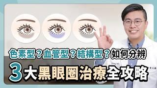 醫美專家揭露黑眼圈消除秘技！黑眼圈的4大致命敵！你中招了嗎？教你如何消掉黑眼圈~ #黑眼圈 #醫美 #皮秒雷射 #5d亮睛術