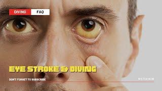 Diving After An Eye Stroke