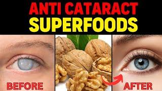 Prevent Cataracts Surgery! Top 10 Superfoods that slow down cataract| Top 5 Eye exercises.