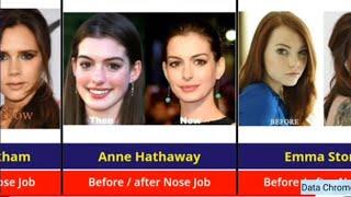 Hollywood celebrities before and after nose job #nosejobbeforeandafter #nosejobs #hollywoodcelebrity